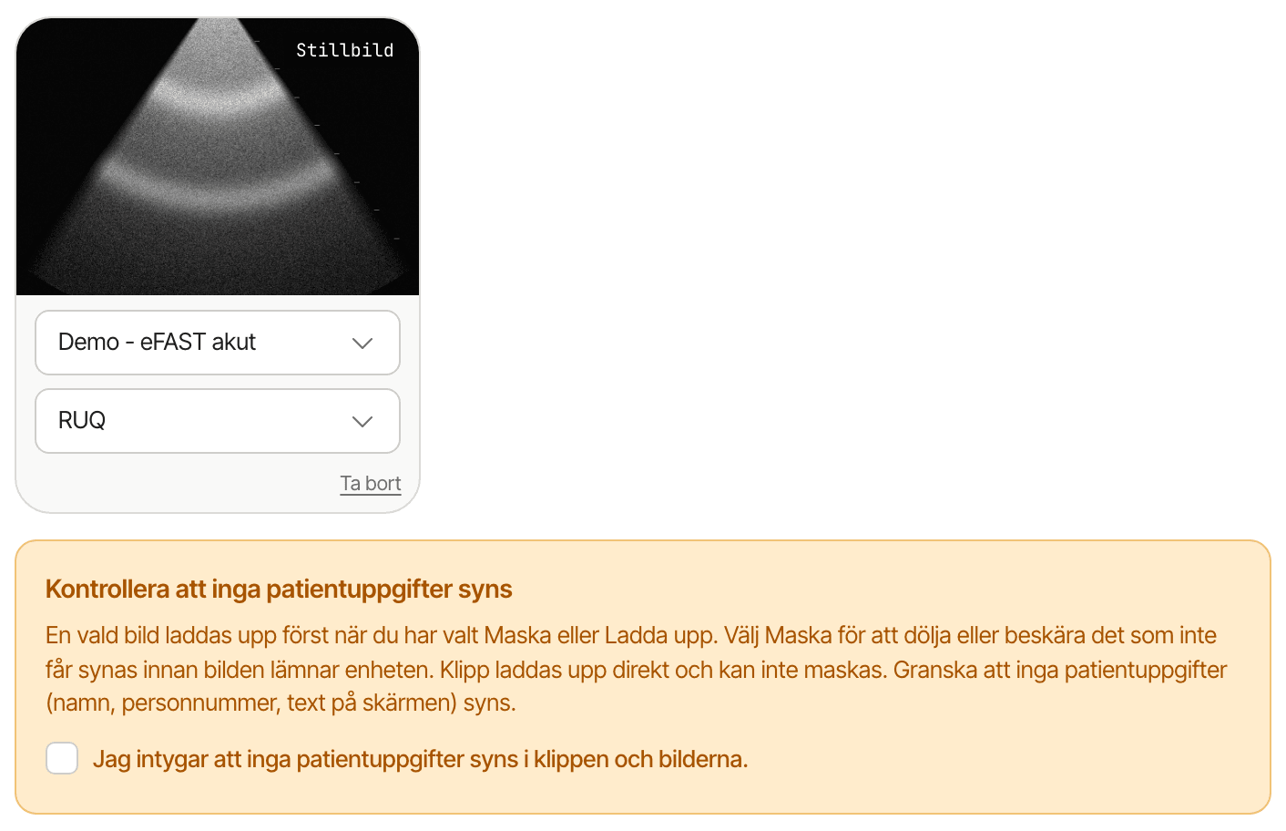 Ett klippkort med statusen Stillbild, modulen och vyn valda i två listor och knappen Ta bort, och under kortet rutan Kontrollera att inga patientuppgifter syns med en okryssad intygsruta.