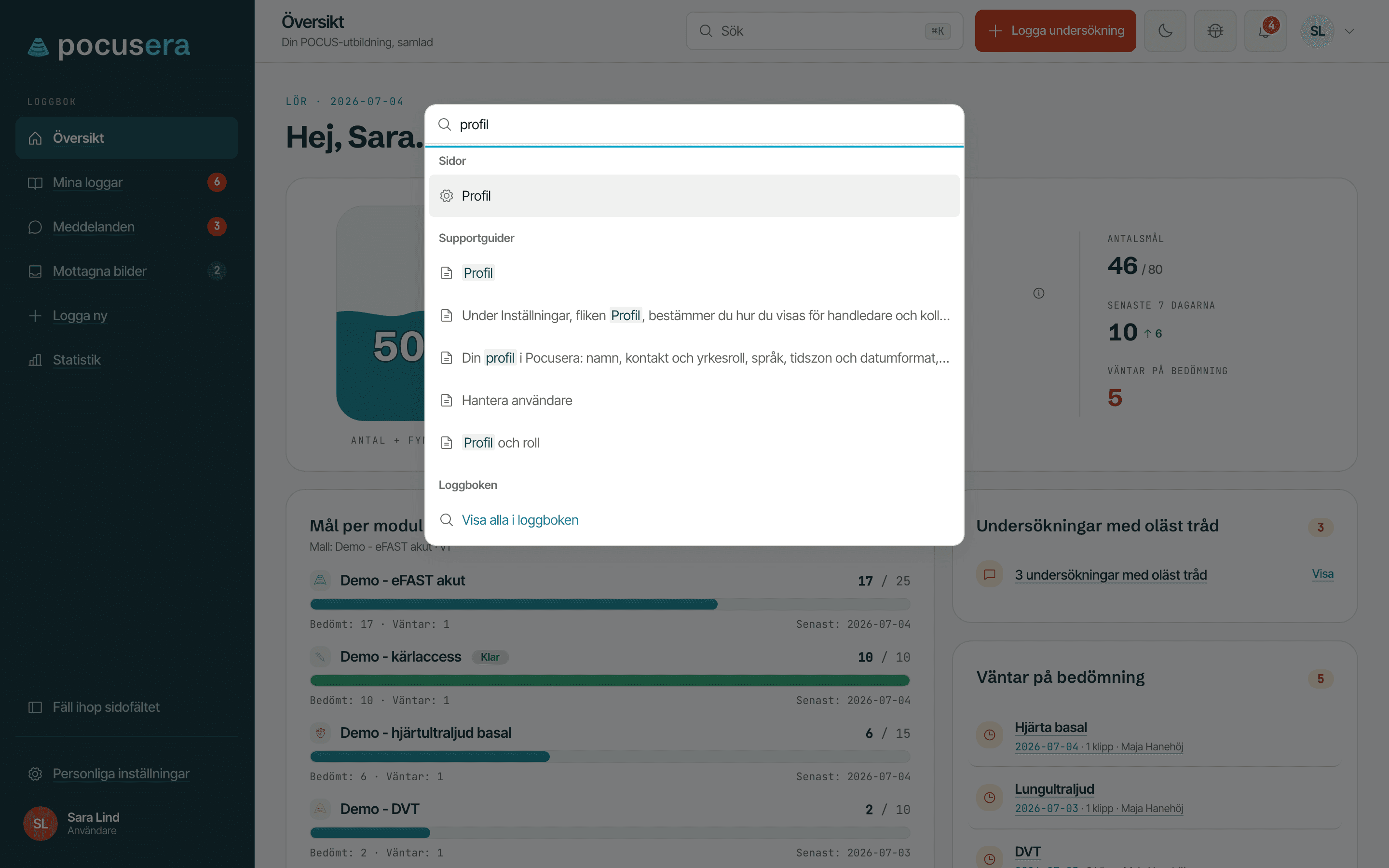Översikten med sökpaletten öppen för frågan profil, gruppen Sidor med Profil, gruppen Supportguider med fem träffar, gruppen Loggboken med länken Visa alla i loggboken och knappen Sök med kortkommandot i toppraden.